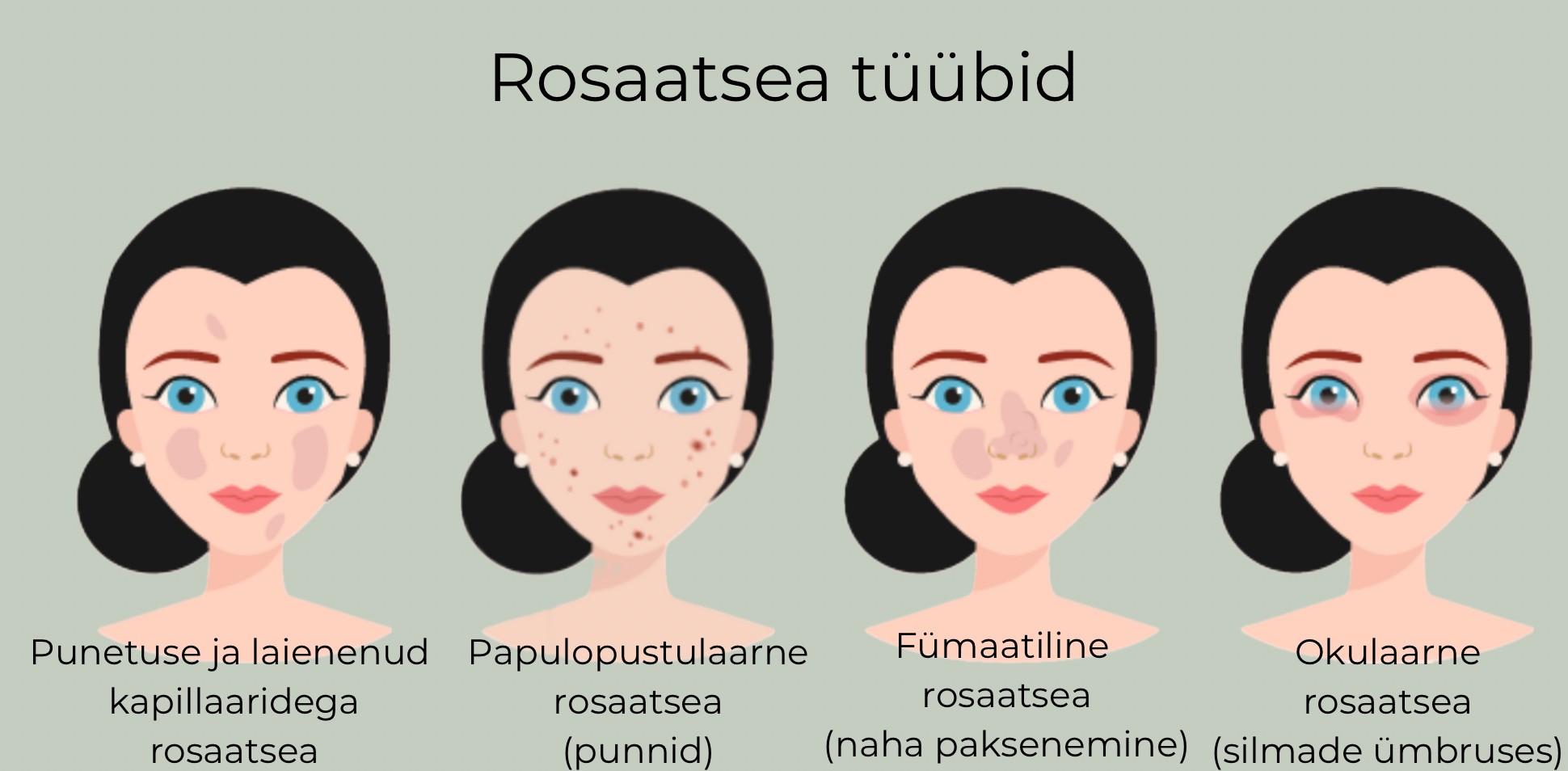 Rosaatsea tüübid