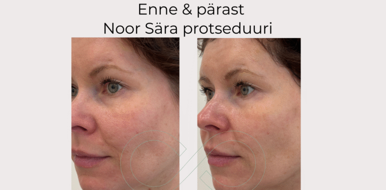 Noor Sära enne ja pärast