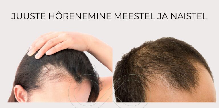 Juuste hõrenemine meestel ja naistel